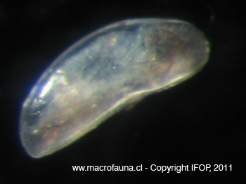 Ostracodo sp7