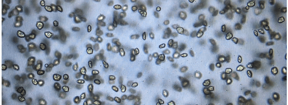 IFOP investiga la Floración de la microalga ictiotóxica Heterosigma akashiwo en el fiordo Comau, abril 2021