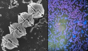 Cadena de 4 células de Alexadrium catenella (microscopio electrónico de barrido) (mano izquierda) Fotomicrografía de la floración de este momento (gentileza César Alarcón)
